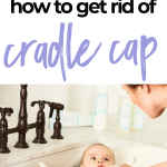 How To Get Rid of Cradle Cap With One Simple Natural Remedy